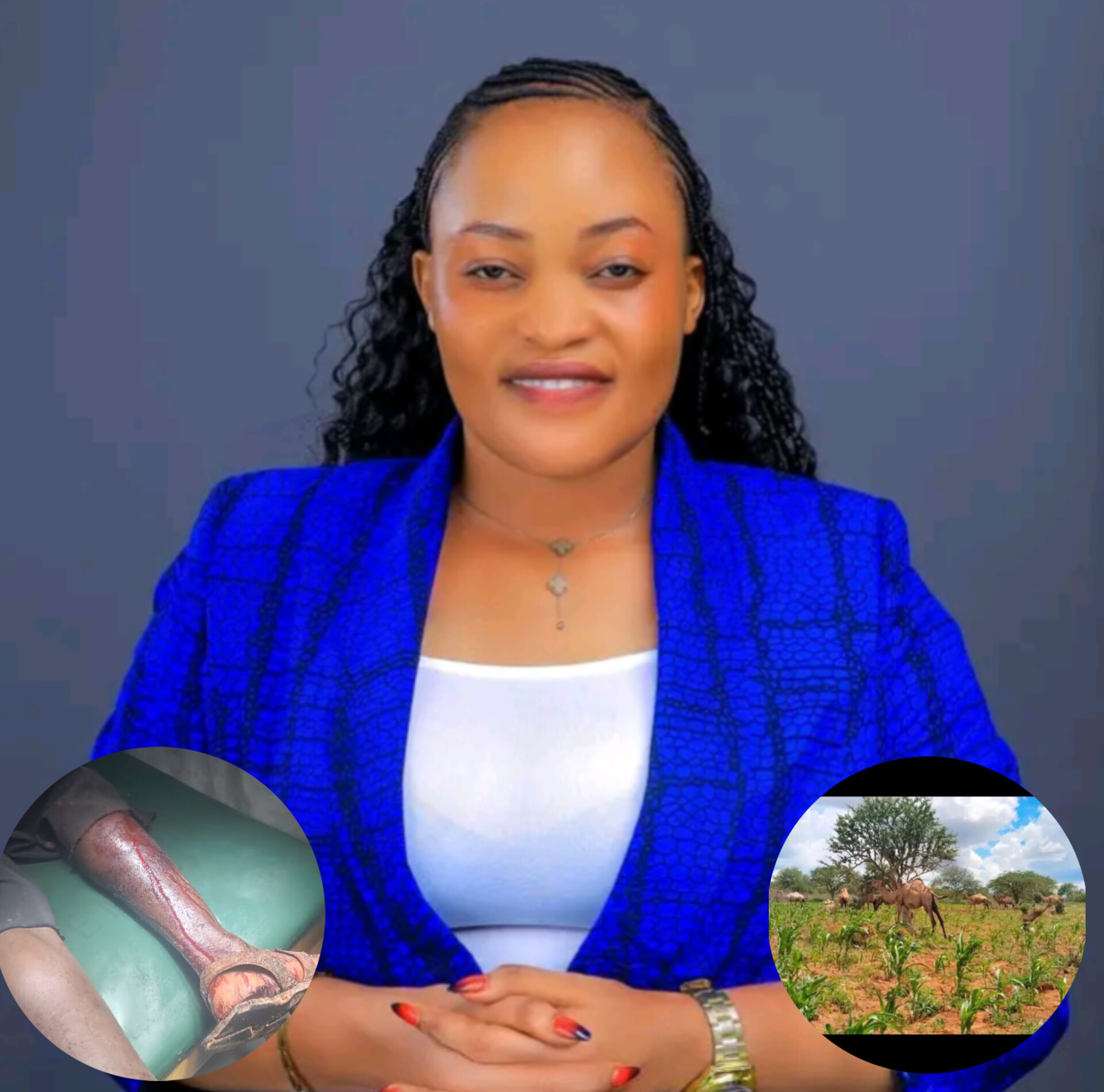Tumechoka Sasa; Incoming Kitui Women Rep Agnes Mawia Condemns Residents Attack By Camel Herders in Mwingi North Area After  One Man Shot Injured Seriously(Photos)